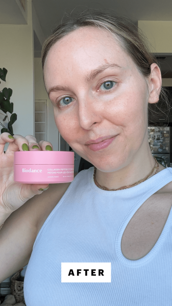 Kinonen after applying the Biodance Collagen Peptide Eye Patches