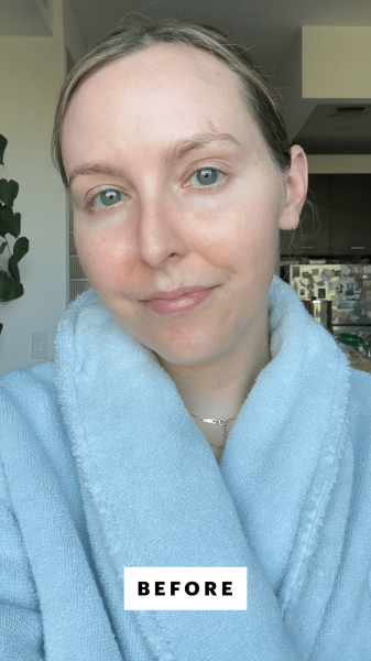Kinonen before applying the Biodance Collagen Peptide Eye Patches