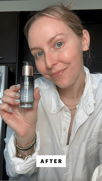 Kinonen after applying the Mara Flower Acid Algae Serum